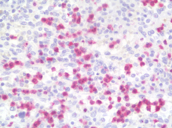 Calprotectin Antibody