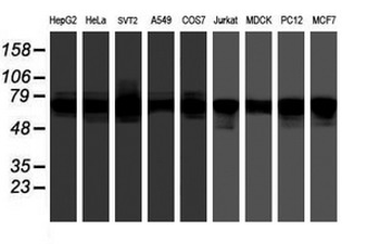FMR1/FMRP Antibody