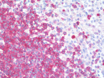CD22 Antibody