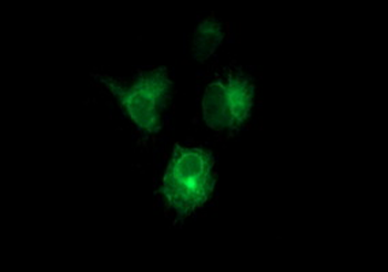 CD22 Antibody