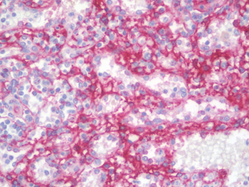 CD105 Antibody