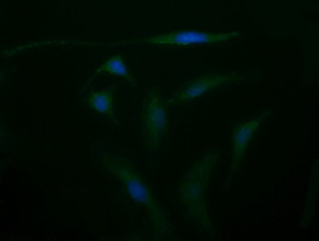 CD105 Antibody