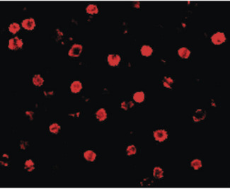 CDH13 / Cadherin 13 Antibody