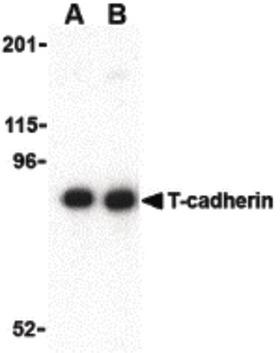 CDH13 / Cadherin 13 Antibody