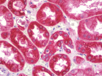 HSD3B7 Antibody (aa121-170)