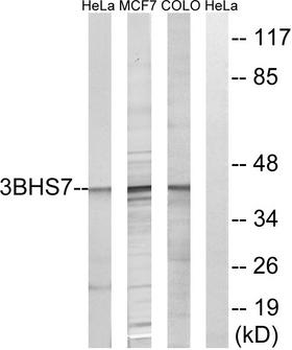 HSD3B7 Antibody (aa121-170)