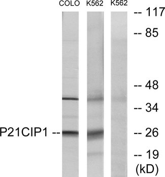 CDKN1A / WAF1 / p21 Antibody (aa111-160)