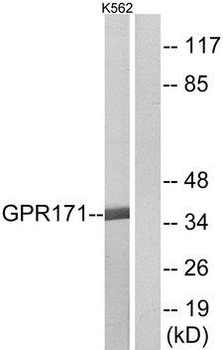 GPR171 Antibody (aa141-190)