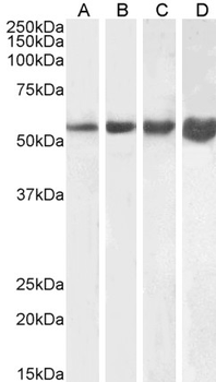 DES / Desmin Antibody (aa454-468)