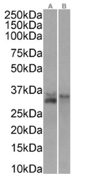 Anti-CD74 [LL1 (EPB1)]