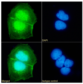 Anti-UBE2C [SAIC-41A-1]