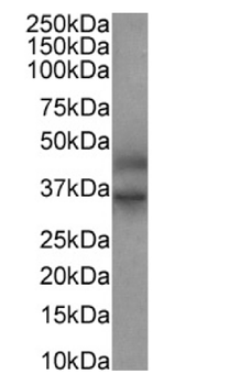 Anti-FEN1 [SAIC-21C-4]