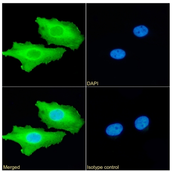 Anti-CALR [SAIC-16D-6B9]