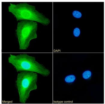 Anti-ANXA1 [SAIC-13B-19]