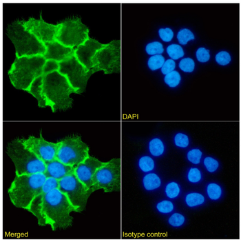 Anti-EGFR [2F8 (Zalutumumab; HuMax-EGFR)]