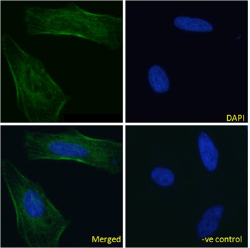 Anti-EGFR domain III [h-R3 (Nimotuzumab)]