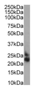 Anti-CD52 [HI186 ]