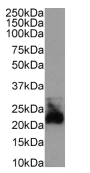 Anti-CD52 [CF1D12]