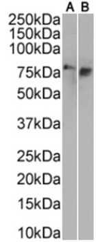 Anti-Tau Oligomeric complex [TOC1]