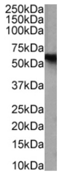 Anti-CD25 [7D4]