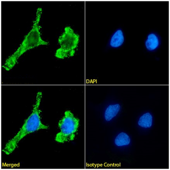Anti-CA125 [20E3]