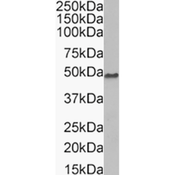 Anti-Beta Dystroglycan [P38G1]