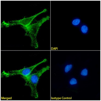 Anti-Laminin-2 LG5 [C3_Hu10]