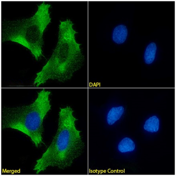 Anti-Mesothelin [MB]