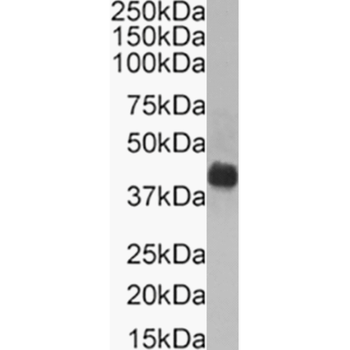 Anti-Mesothelin [MB]