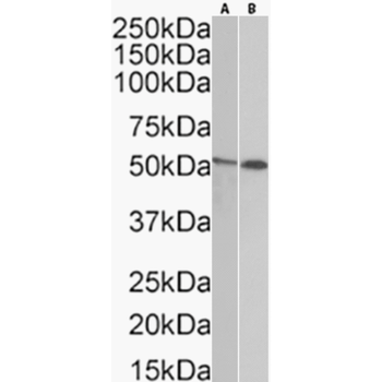 Anti-Desmin [14G1C12]