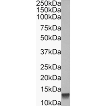 Anti-IL-8 [WS-4]