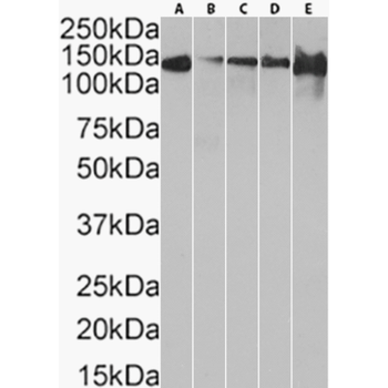 Anti-Cadherin 17 [D2111]