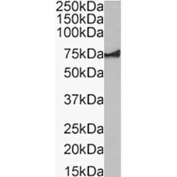Anti-Glypican 3 [15G1]