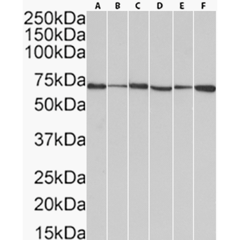 Anti-HSP70 [cmhsp70.1 (C92F3B1)]