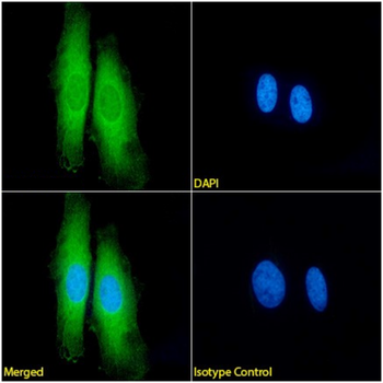 Anti-HSP70 [cmhsp70.1 (C92F3B1)]