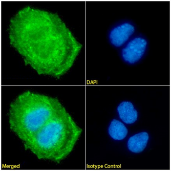 Anti-Cytokeratin 20 [10A2]