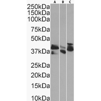 Anti-Cytokeratin 20 [10A2]