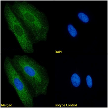Anti-Modified cytokeratin [COU-1]
