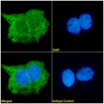 Anti-Cytokeratin 14 [2G4]
