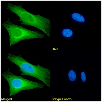 Anti-Cytokeratin 8 [TS1]