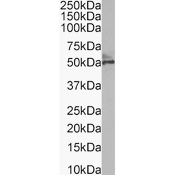 Anti-Cytokeratin 8 [TS1]