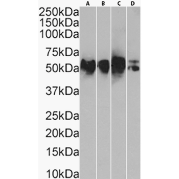 Anti-CD147 [5F6]