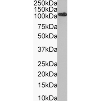 Anti-PSMA [11d1e5E10]