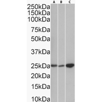 Anti-BCMA [I09]