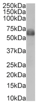 Anti-CD47 [ZF1]