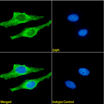 Anti-Amyloid Beta [21F12]