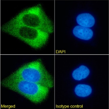 Anti-GM2 ganglioside [KM966]