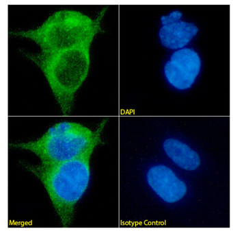 Anti-Mesothelin [K1]