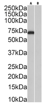 Anti-Softag 1 [NT73]