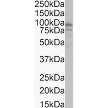 Anti-Progesterone Receptor [14B3]